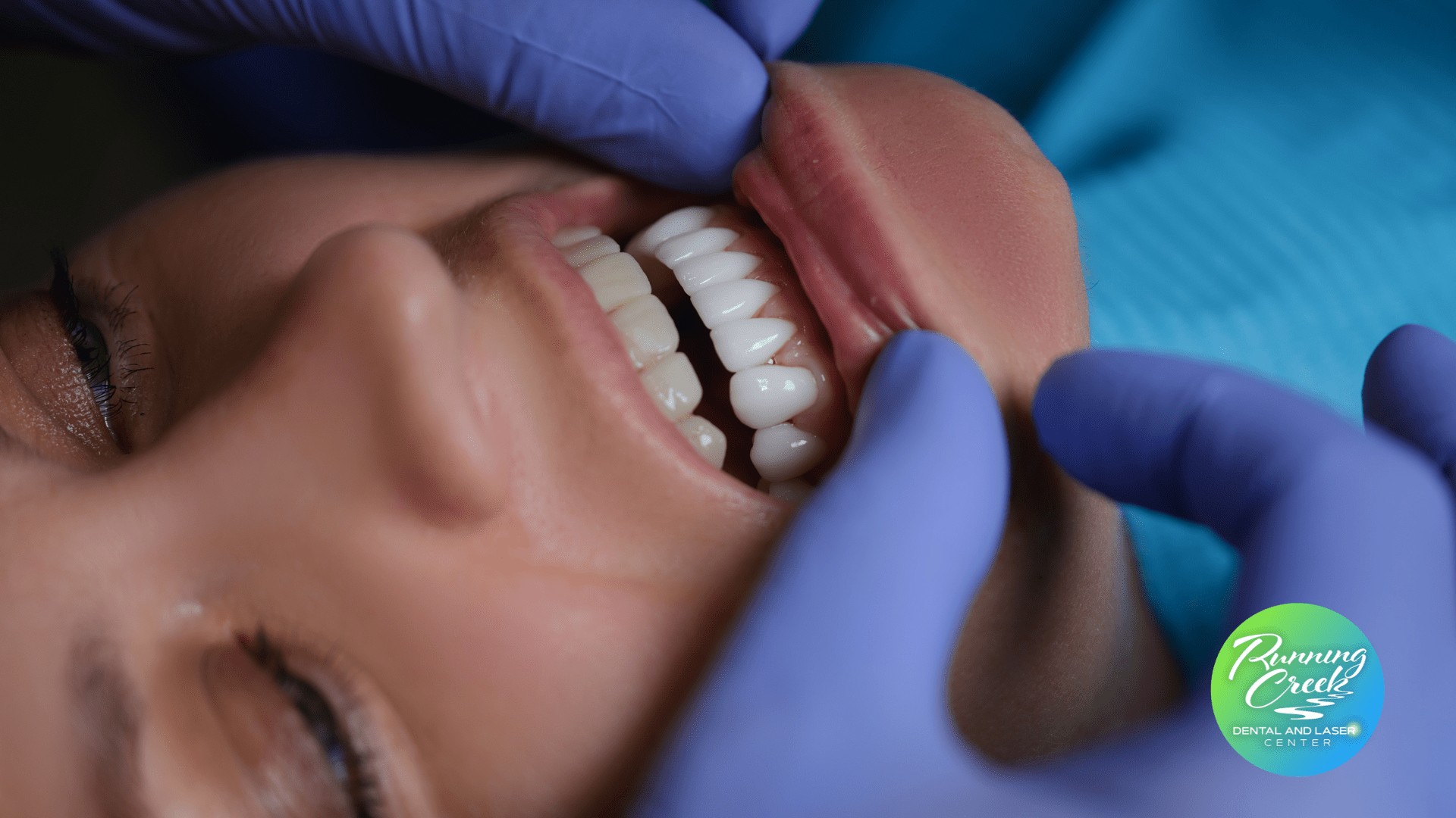 A woman is getting her teeth examined by a dentist.